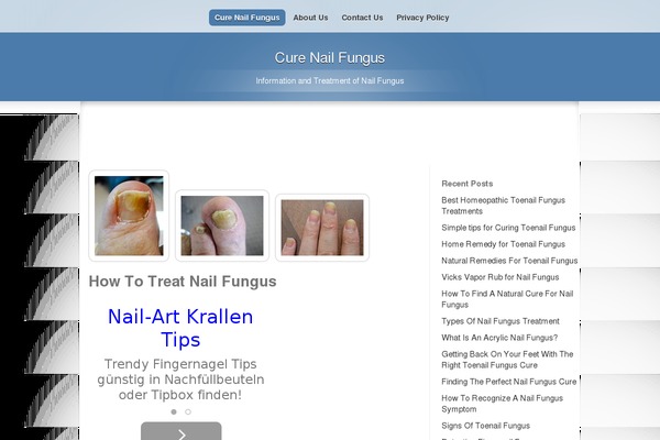 cure-nail-fungus.com site used Clickbump4